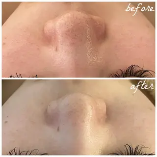 メンズ メナード岐阜茜部 杉浦のエステ・リラクイメージ