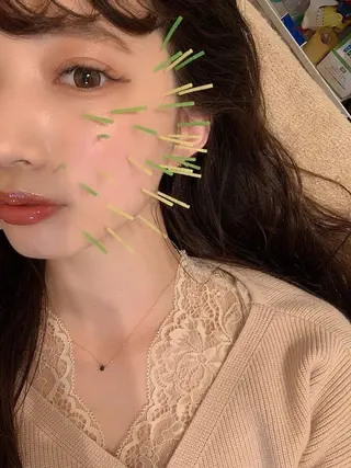 鍼灸整骨院Refine所属・鍼灸 Refineのその他イメージ