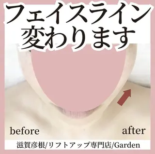リフトアップ専門店 Gardenこやまのエステ・リラクイメージ