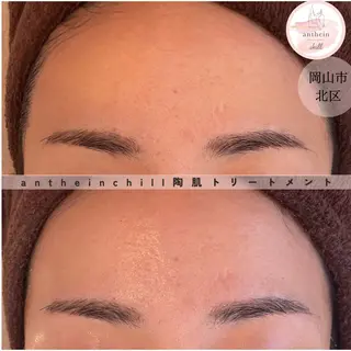 アンテインチル 山本のエステ・リラクイメージ