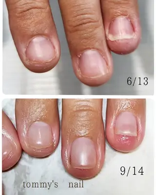 ネイル tommy's nail所属・福岡/若よもぎ蒸し 全身美容が叶うサロンのネイルデザイン