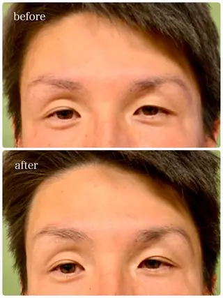 メンズ 美容鍼 IKEZAKIのエステ・リラクイメージ