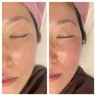 lafleur Yurinaのエステ・リラクイメージ