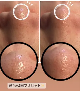 ピーリング専門店 Belluteのエステ・リラクイメージ