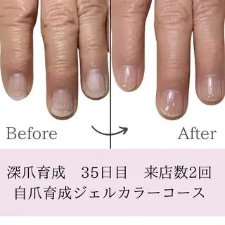 ネイル 𝐴𝑁𝑈𝐸 深爪育成専門サロンのネイルデザイン