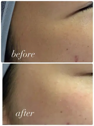 extranails ／lemellaのネイルデザイン