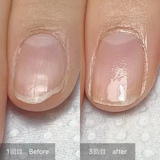 ネイル 木村 千晴のネイルデザイン