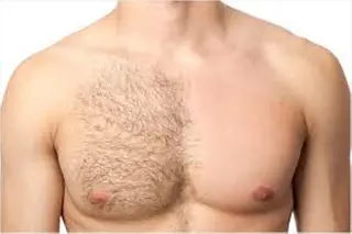 salon Sunny所属・脱毛salon Sunnyのエステ・リラクイメージ