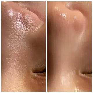 Mandarin Orange所属・毛穴から始める肌メン テマンダリンオレンジのエステ・リラクイメージ