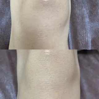 メンズ キッズ 脱毛SALON RaYNiCKのエステ・リラクイメージ