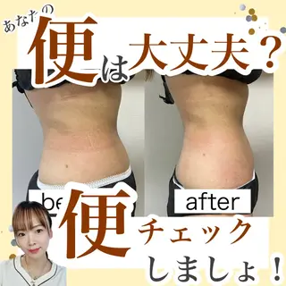 Beauty   Salon  Adiy所属・Adiy ikumiのエステ・リラクイメージ