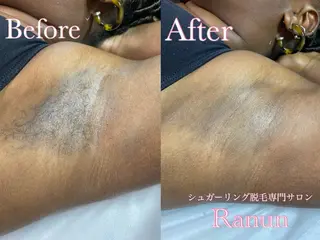 マツエク・マツパ シュガーリング脱毛 専門店Ranunのエステ・リラクイメージ