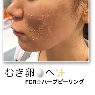 FLEUR大阪・美容 整体・痩身・小顔のエステ・リラクイメージ