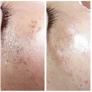 目元・まつパ・美肌フ ェイシャル谷町四丁目のマツエク・マツパデザイン