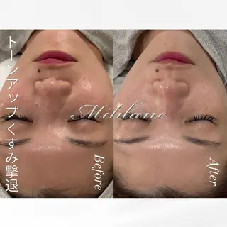 肌質管理 MIBLANC上野店のエステ・リラクイメージ