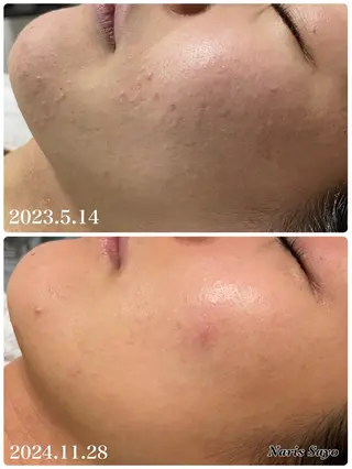 デ・アイム豊中所属・朝山 紗世子のエステ・リラクイメージ