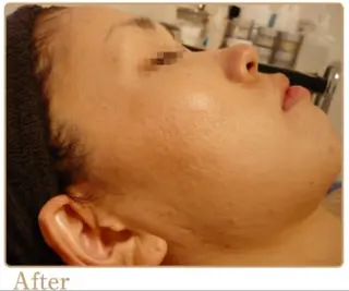 ピーリングサロン シャンテール所属・ピーリングサロン シャンテールのエステ・リラクイメージ