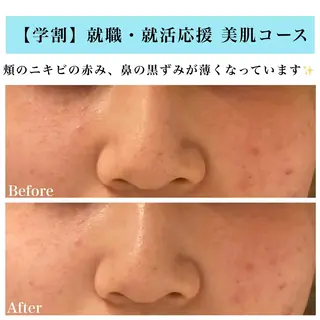 Bellesthe (ベルエステ)のエステ・リラクイメージ