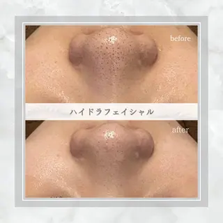 ENCHANT Kaede/肌質改善のその他イメージ