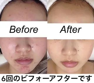 セミロング カラー パーマ ネイル マツエク・マツパ 都度払い肌質改善 &脱毛Blancheのエステ・リラクイメージ