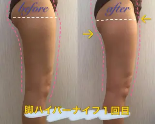 OPREA 栄店のエステ・リラクイメージ