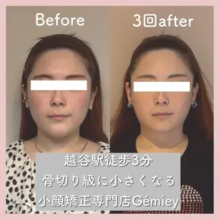 小顔矯正専門店Gémiey所属・越谷駅徒歩３分 小顔専門Gemieyのエステ・リラクイメージ