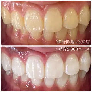 メンズ ホワイトニングルーム 川崎店所属・ホワイトニング ルーム 川崎店のその他イメージ