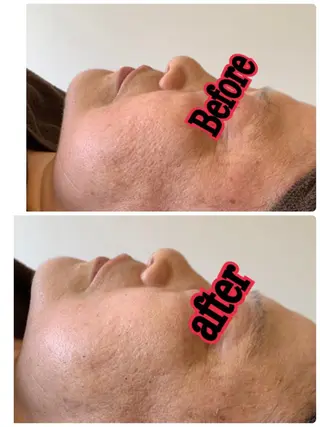 espoir エスポワールのネイルデザイン