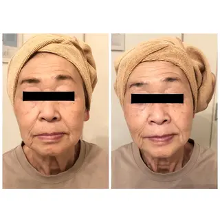 おうちサロン B-ROOMのエステ・リラクイメージ