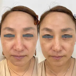 ポーラザビューティー 松原店のエステ・リラクイメージ