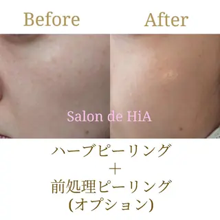 Salon de HiAのエステ・リラクイメージ