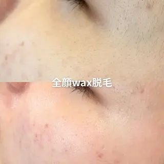 EST BEAUTY所属・顔専門ワックス脱毛/ ハーブピーリングのエステ・リラクイメージ