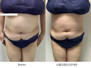 冷却専門店 SLARIのエステ・リラクイメージ