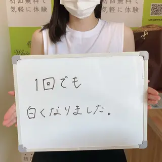 White Berry SELF BEAUTY SALON所属・セルフホワイトニング 🦷口元垢抜け✨のその他イメージ