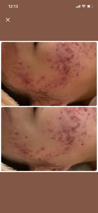 メンズ キッズ 肌質改善・脱毛サロン Luangeのエステ・リラクイメージ