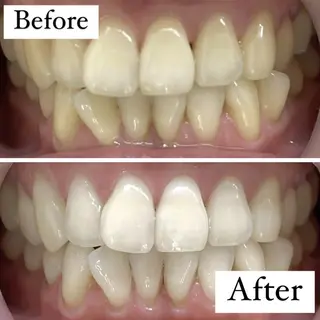 LBSホワイトニング 銀座店💎スタッフ峯のその他イメージ