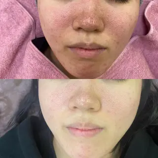 siro スタッフのエステ・リラクイメージ