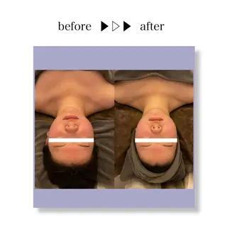 ☆痩身/小顔☆ 結果出します☆のエステ・リラクイメージ