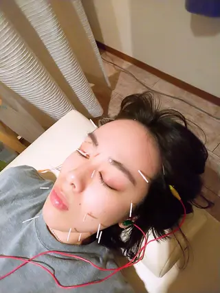 むくみたるみ専門☆ 美容鍼・小顔矯正のエステ・リラクイメージ