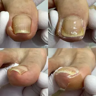 北千住巻き爪矯正院フルフィル所属・北千住巻き爪矯正院 フルフィルのネイルデザイン