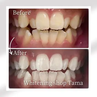 メンズ ホワイトニング ショップ多摩店のその他イメージ