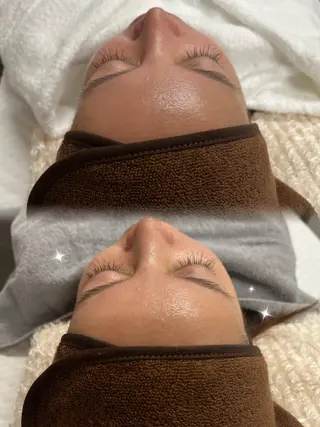 トータルビューティサロンカヌヌ所属・salon kanunuのエステ・リラクイメージ