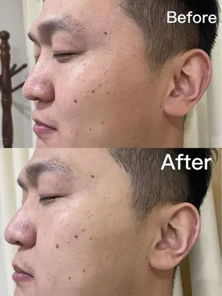 メンズ キッズ Einami 美肌痩身サロンのエステ・リラクイメージ