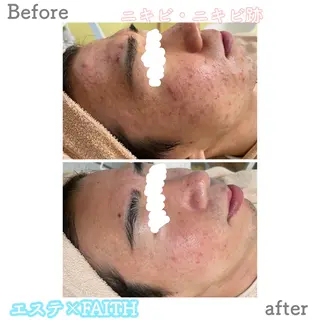 ロング ヘアアレンジ メンズ キッズ ネイル マツエク・マツパ アイブロウ ニキビ&跡改善サロン オーナー光木のエステ・リラクイメージ