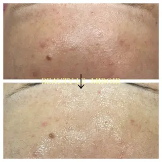 ビューティー ミロワールのエステ・リラクイメージ