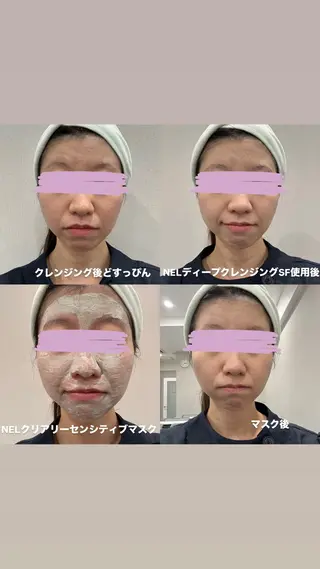 デアイム瀬田所属・高田 穂乃花のエステ・リラクイメージ