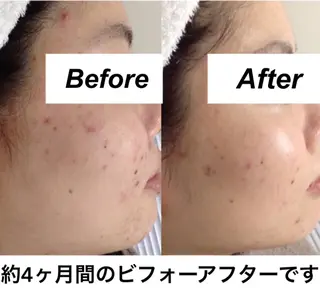 都度払い肌質改善 &脱毛Blancheのエステ・リラクイメージ