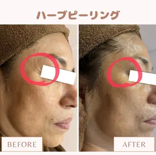 メンズ キッズ Amaryllis 🌹松本のエステ・リラクイメージ