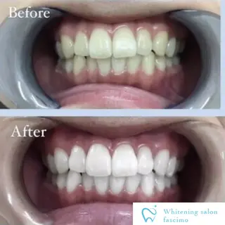 セルフホワイトニングサロンfascimo所属・ホワイトニングサロン fascimo新座店のその他イメージ