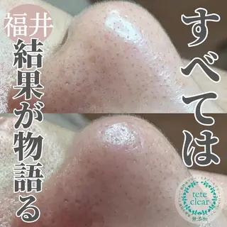 毛穴ケア専門サロン Yourmeユアミーのエステ・リラクイメージ